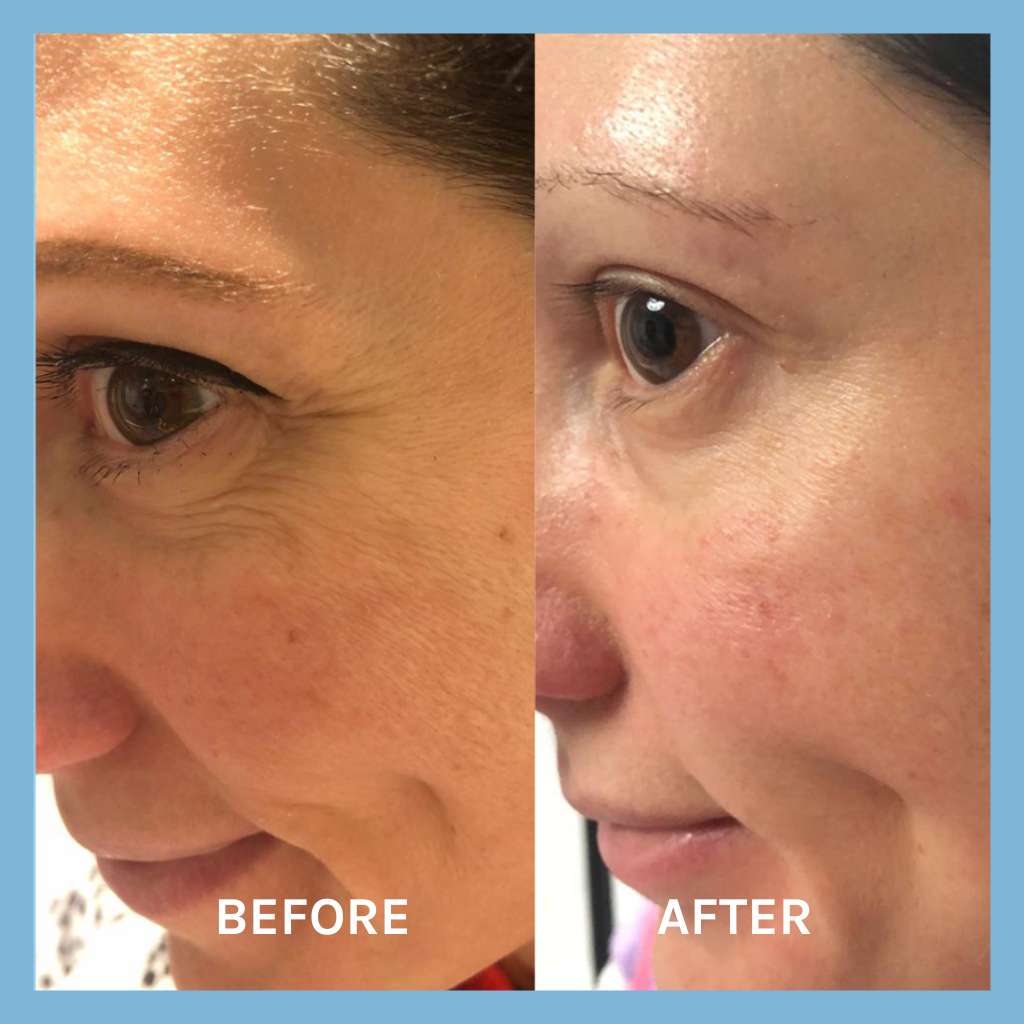 Evolve Age Defying Lifting Serum